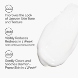 Azelaic Acid Suspension 10% (30ml)