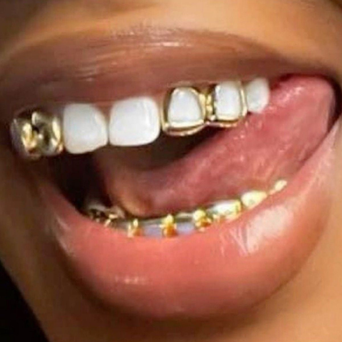 silver grill collection (top & bottom teeth)